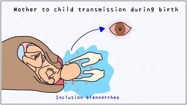 Chlamydia: Morphology, Types, Pathogenesis, Diagnosis, Treatment смотреть онлайн