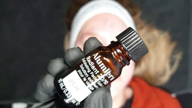 Resurfacing Acne Skin Peel + Targeted Spot Treatment for Inflammation #THESKINSERIES | Aestheticsby смотреть онлайн