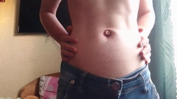 Navel outie hernia
