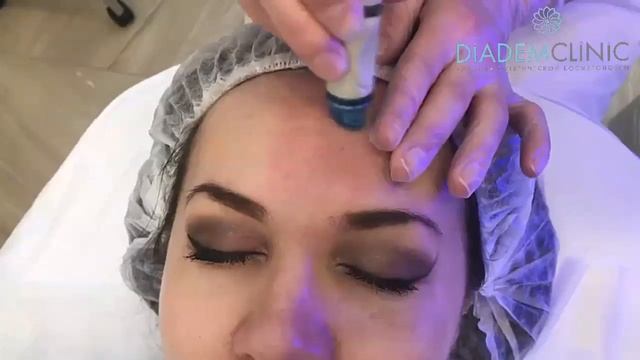Процедура HydraFacial