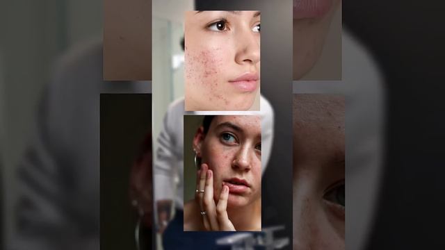 Day 18/90, Best Face Serum for Glowing Skin | Best Serum for Face | Skin Care Tips, Get Glowing Ski смотреть онлайн