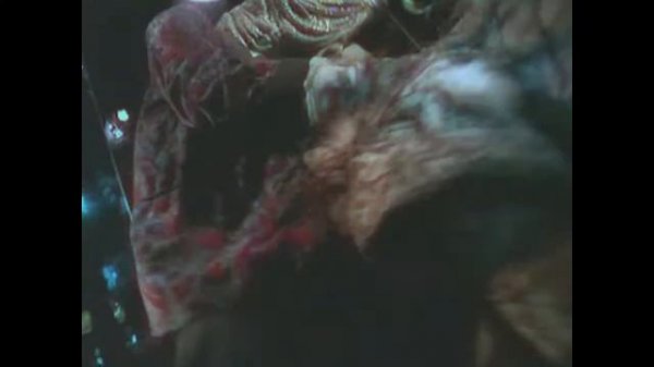 эксгумация