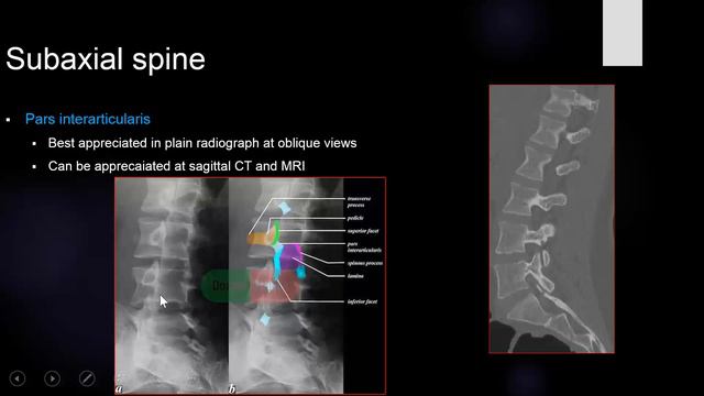 1- Anatomy of the vertebral column смотреть онлайн