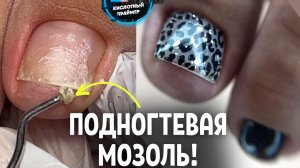 ВОТ ЭТО «ПОДАРОК»! ПЕДИКЮР 8 НЕДЕЛЬ ПОКРЫТИЮ + СТЕРЖНЕВАЯ МОЗОЛЬ + ПОДНОГТЕВАЯ МОЗОЛЬ!