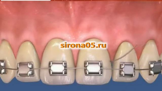 Пользование зубной нитью смотреть онлайн