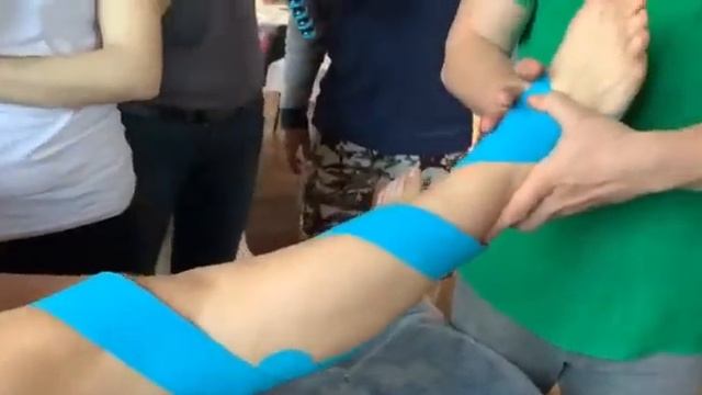 Вальгусная и варусная деформация стопы | Тейпирование смотреть онлайн