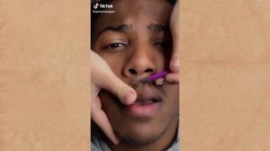 Удаление чёрных точек и прыщей #9