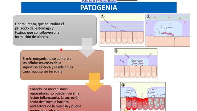 Helicobacter pylori смотреть онлайн