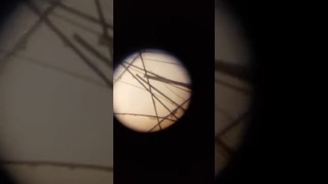 Власоеды у морских свинок смотреть онлайн