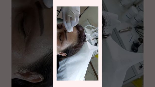 Botulinoterapiya смотреть онлайн