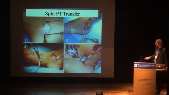 Waisman Center Day with the Experts: Cerebral Palsy 2015 смотреть онлайн