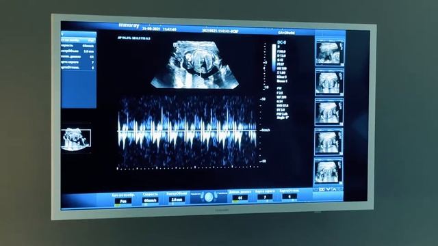 Гендер Пати -Корховские смотреть онлайн