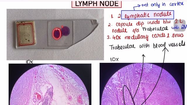 Histology of Lymph Node | Lymphoid System | Anatomy | MBBS | NEET PG | LWY смотреть онлайн