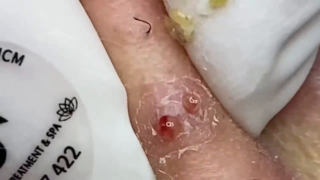 Relax Every Day With Sac Dep Spa New Video 2023 #918 смотреть онлайн