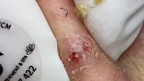 Relax Every Day With Sac Dep Spa New Video 2023 #918