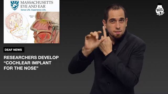 cochlear implant for the nose смотреть онлайн