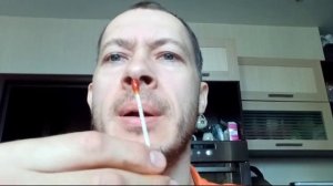 ★ Применение раствора люголя с глицерином от тонзилита. Гланды с гнойнымы пробками пройдут.