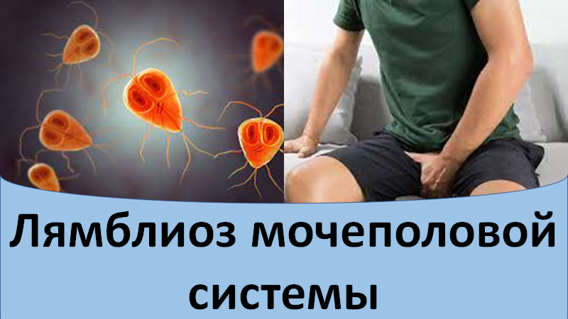 Лямблиоз мочеполовой системы смотреть онлайн