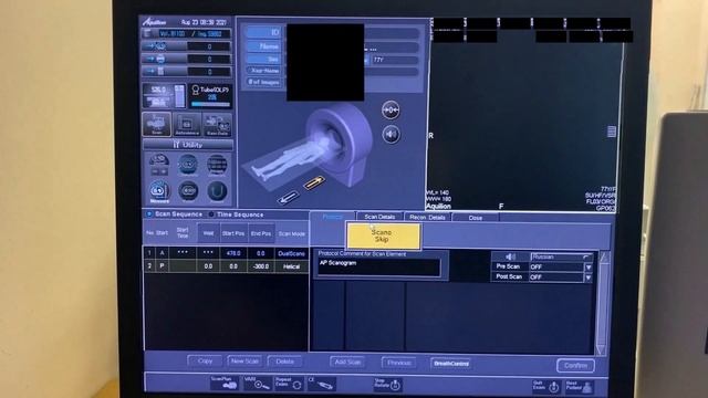 Укладка для КТ ПОП - компьютерной томографии поясничного отдела позвоночника