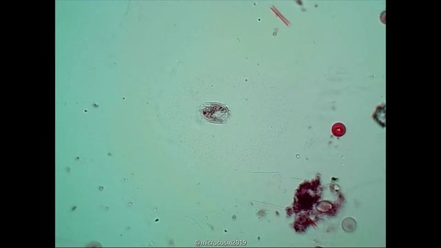 Euplotes. смотреть онлайн