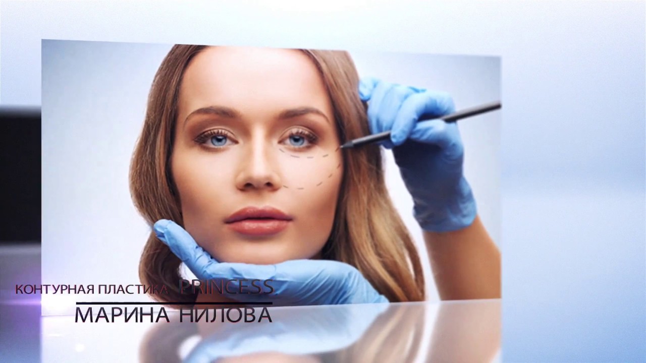 Легко и быстро поднимаем уголки рта - контурная пластика губ Princess. смотреть онлайн