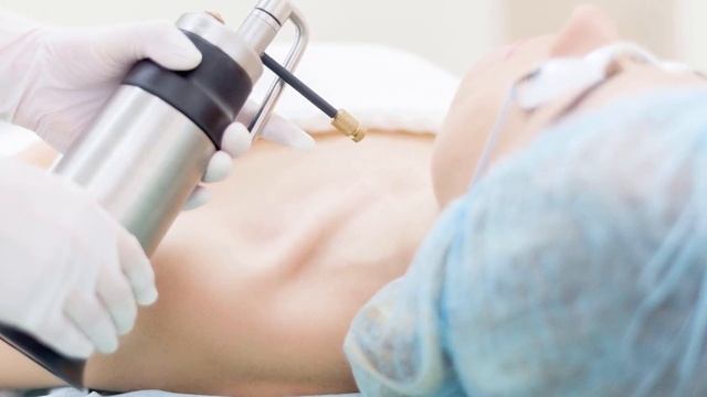 Вот КАК Удаляют Бородавки С КОЖИ смотреть онлайн