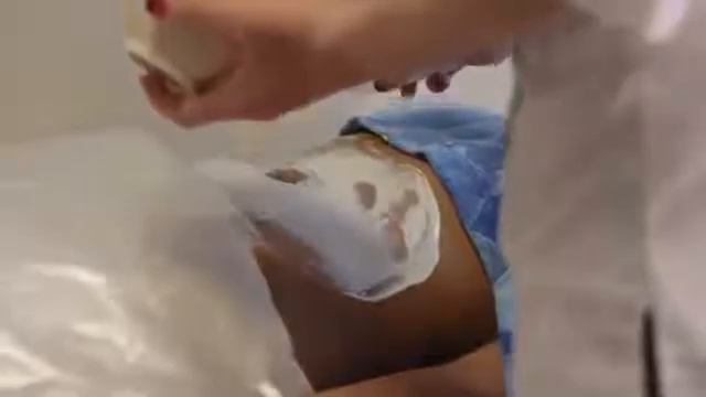 Aurora Симбион СимбионМ курунга Отзывы врачей и пациентов смотреть онлайн