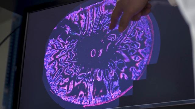 “Gut Touch” Research and Mechanistic Pathways смотреть онлайн