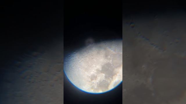 Live Moon | 9th Day
