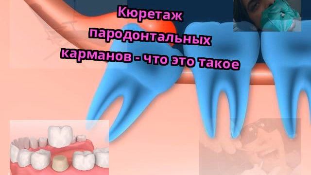 Каратэ: Подростковые Техники и Уроки