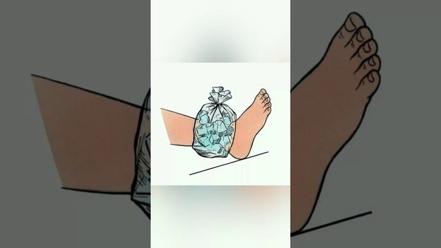 ПМП при порезах, ушибах, ссадинах. смотреть онлайн