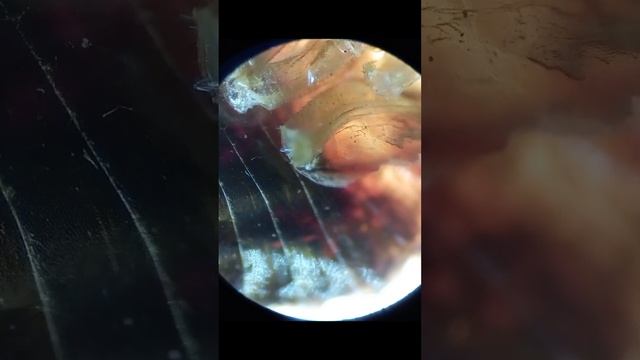 Рыжий Таракан Под Микроскопом смотреть онлайн