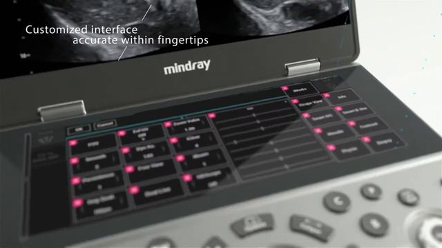 Mindray MX7 - переносной УЗ-сканер высокого класса | uzimir.ru смотреть онлайн