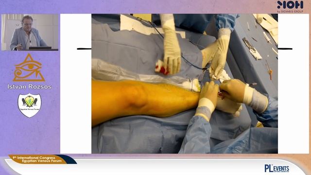 Egyptian Venous Forum 2022 | Session 01 | 03- Istvan Roses смотреть онлайн