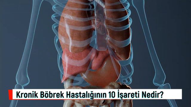 Kronik Böbrek Hastalığının 10 İşareti! Kronik böbrek hastalığı nedir? смотреть онлайн