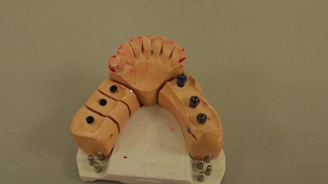 Протезирование на имплантах мультиюниты плюс классическая винтовая фиксация смотреть онлайн