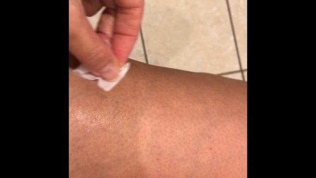 How to inject Cosentyx Prefilled Syringe смотреть онлайн