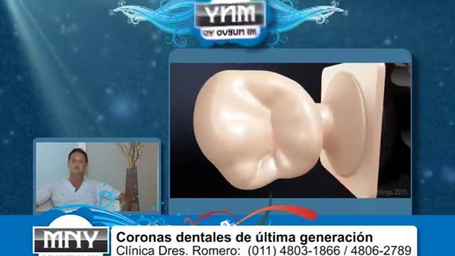 Dres. Romero - Micro Coronas смотреть онлайн