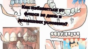 Как избавиться от флюса за день в домашних условиях?