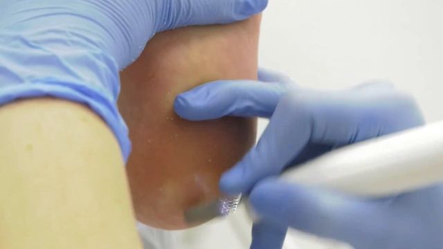 "Подиатриклаб": Мы решаем проблемы стоп и ногтей. смотреть онлайн