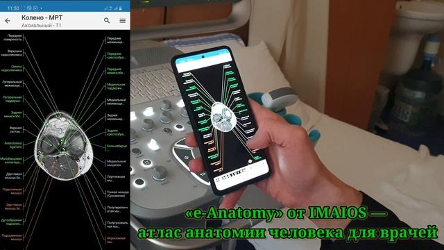 Программы для врачей: анатомия МРТ, КТ, 3D смотреть онлайн