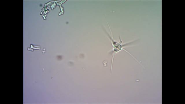 Амеба radiosa Ehrenberg Under Microscope смотреть онлайн