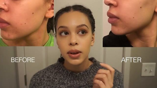 Резултаты использования крема Mizon All In One Snail Repair Cream в течении 2-х недель смотреть онлайн