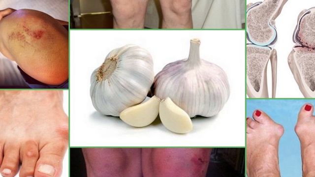 Зачем НАДО ОБЯЗАТЕЛЬНО СЪЕДАТЬ 3 ЗУБЧИКА ЧЕСНОКА ЕЖЕДНЕВНО ? Это НАДО ЗНАТЬ ! смотреть онлайн