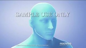 Гамма нож в лечении невралгии тройничного нерва.