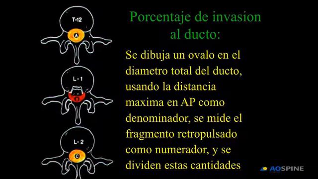 Actualización en el manejo de las fracturas toracolumabares смотреть онлайн