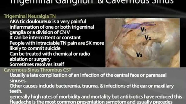 41 Trigeminal Nerve смотреть онлайн