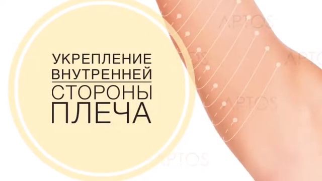 Нитевой лифтинг Аптос в Евро-Шарм смотреть онлайн