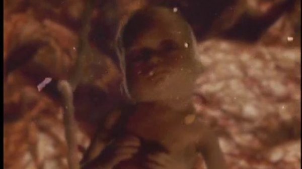 Massive Attack - Teardrop  (Directed By Walter Stern)