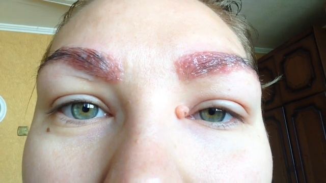 Аллергия на хну! Я в шоке! Опухли глаза и брови! Что делать если аллергия на хну? смотреть онлайн
